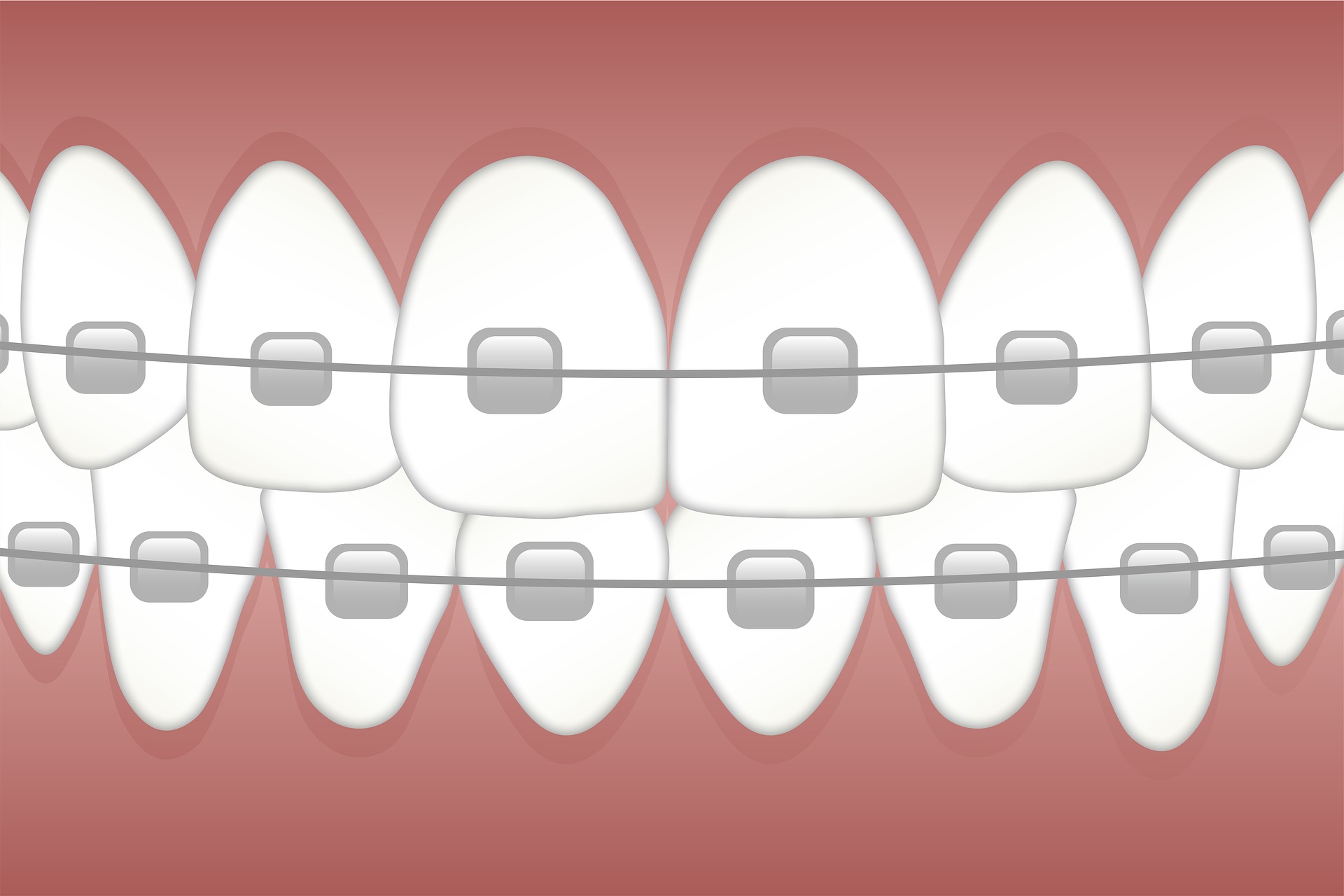 ortho